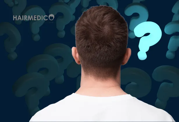 Surexploitation de la zone donneuse : les cheveux peuvent-ils repousser après l’extraction ?