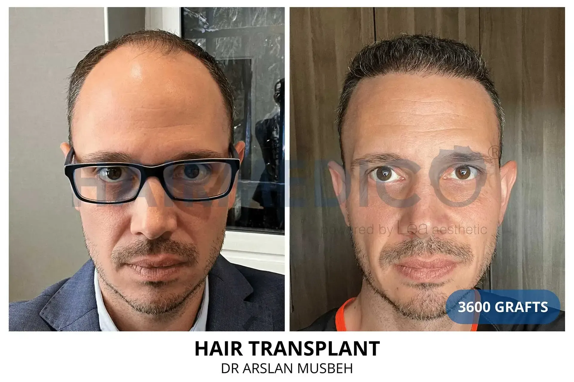 Résultat 6