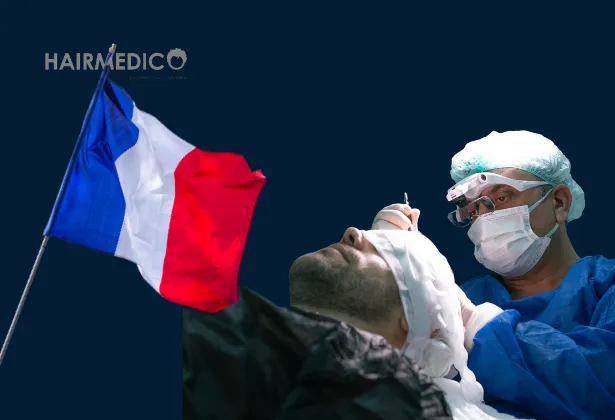 Пересадка волос в Марселе: естественные результаты с Hairmedico France