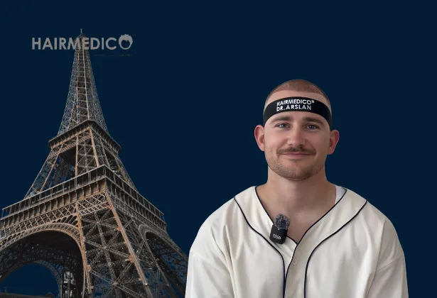 Greffe de cheveux Paris 2025 : Le guide complet de la restauration capillaire avancée en France