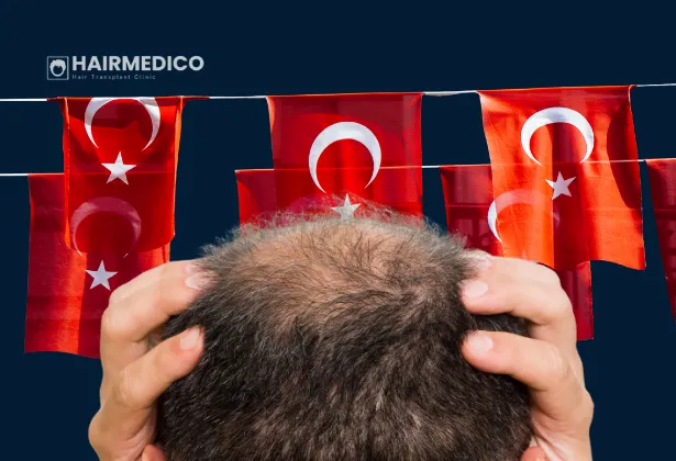 هل يستحق الأمر السفر إلى تركيا لإجراء عملية زراعة شعر في عام 2026؟