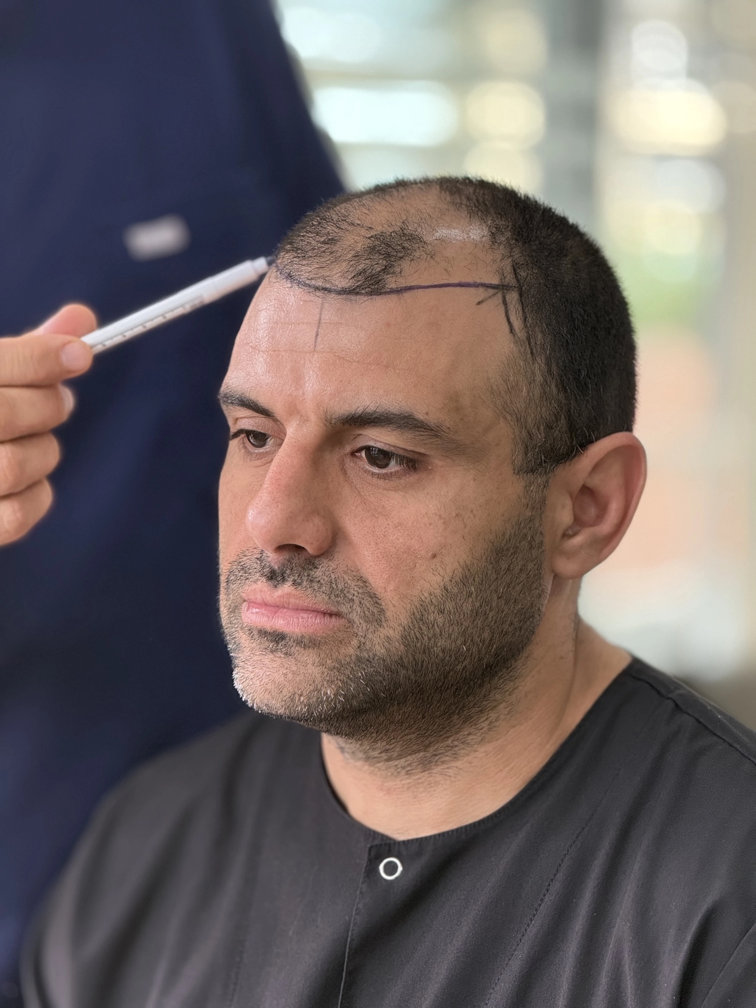 Dr. Arslan Musbeh performing a hair analysis at the Hairmedico clinic in Istanbul