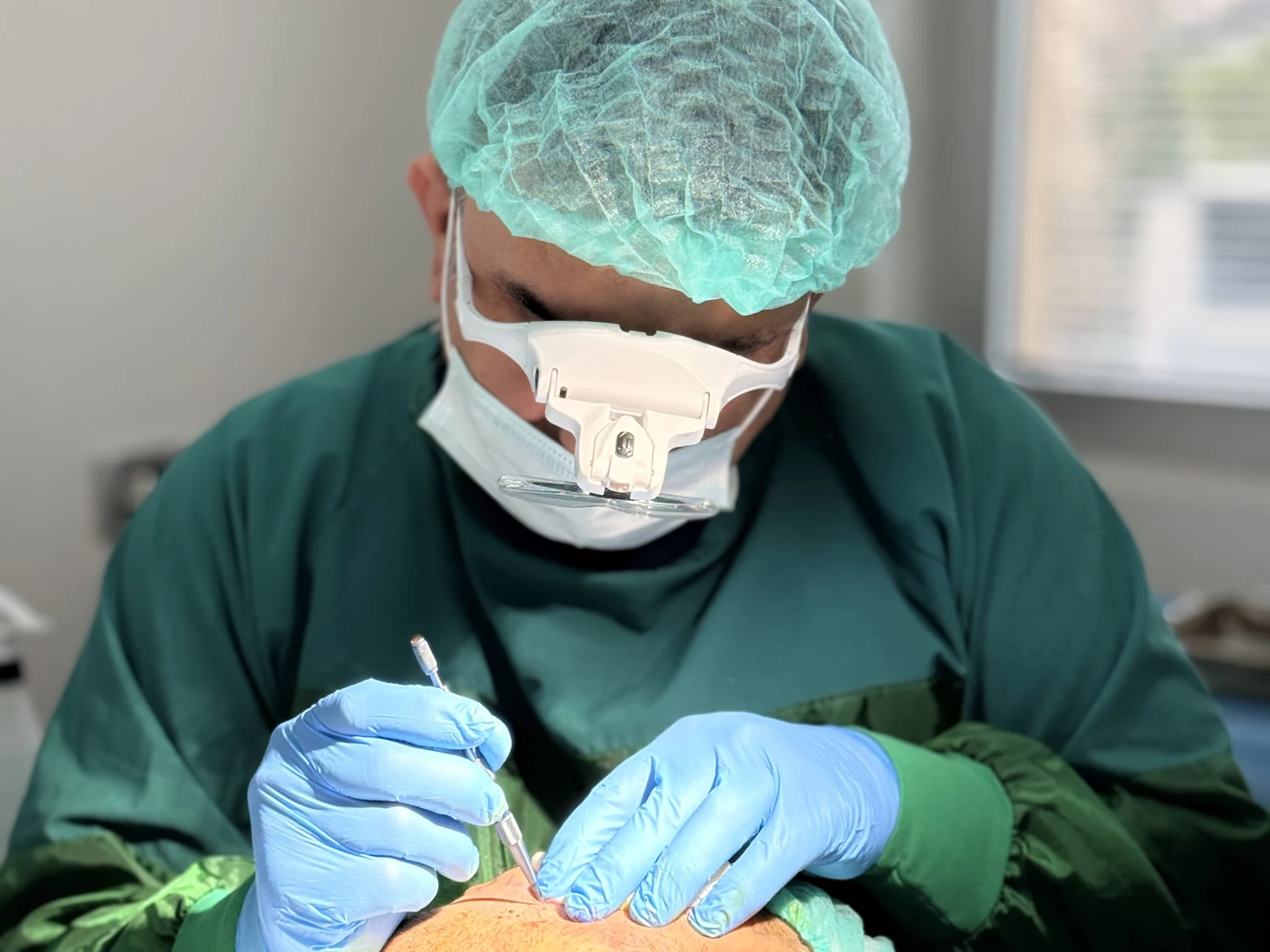 Dr. Arslan Musbeh personally performing follicle extraction with surgical loupes during an FUE procedure