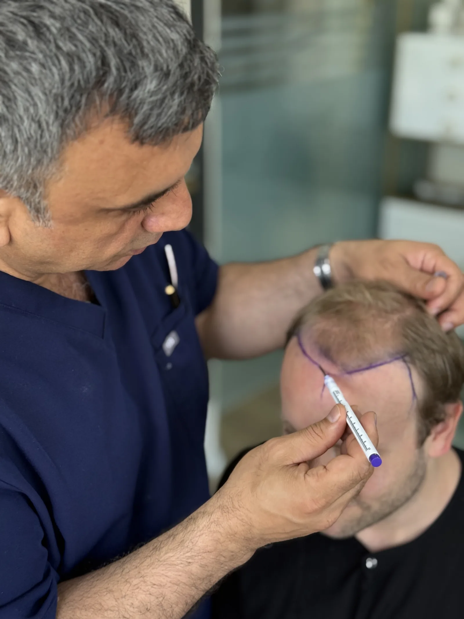 Dr. Arslan measuring a patient's hairline with a ruler during a Hairmedico consultation in Istanbul