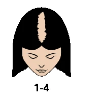 L1-4