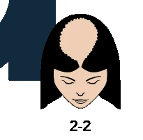 L2-2