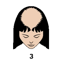 L3