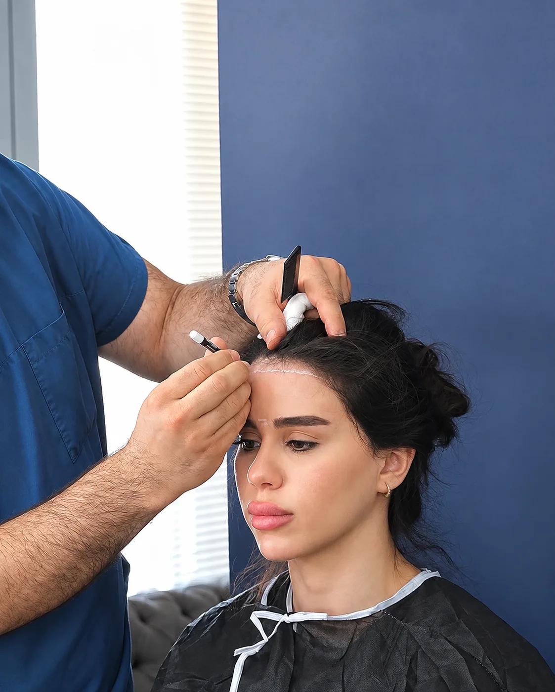 Hairline design consultation at Hairmedico Istanbul