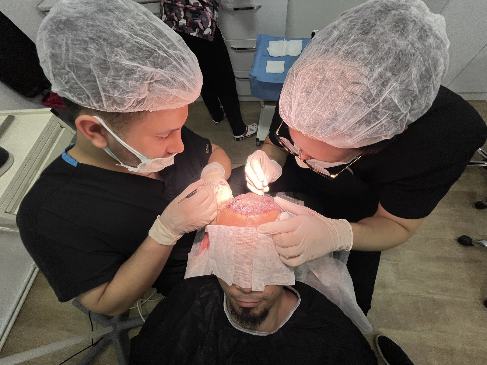 Close-up of graft handling during DHI implantation at Hairmedico