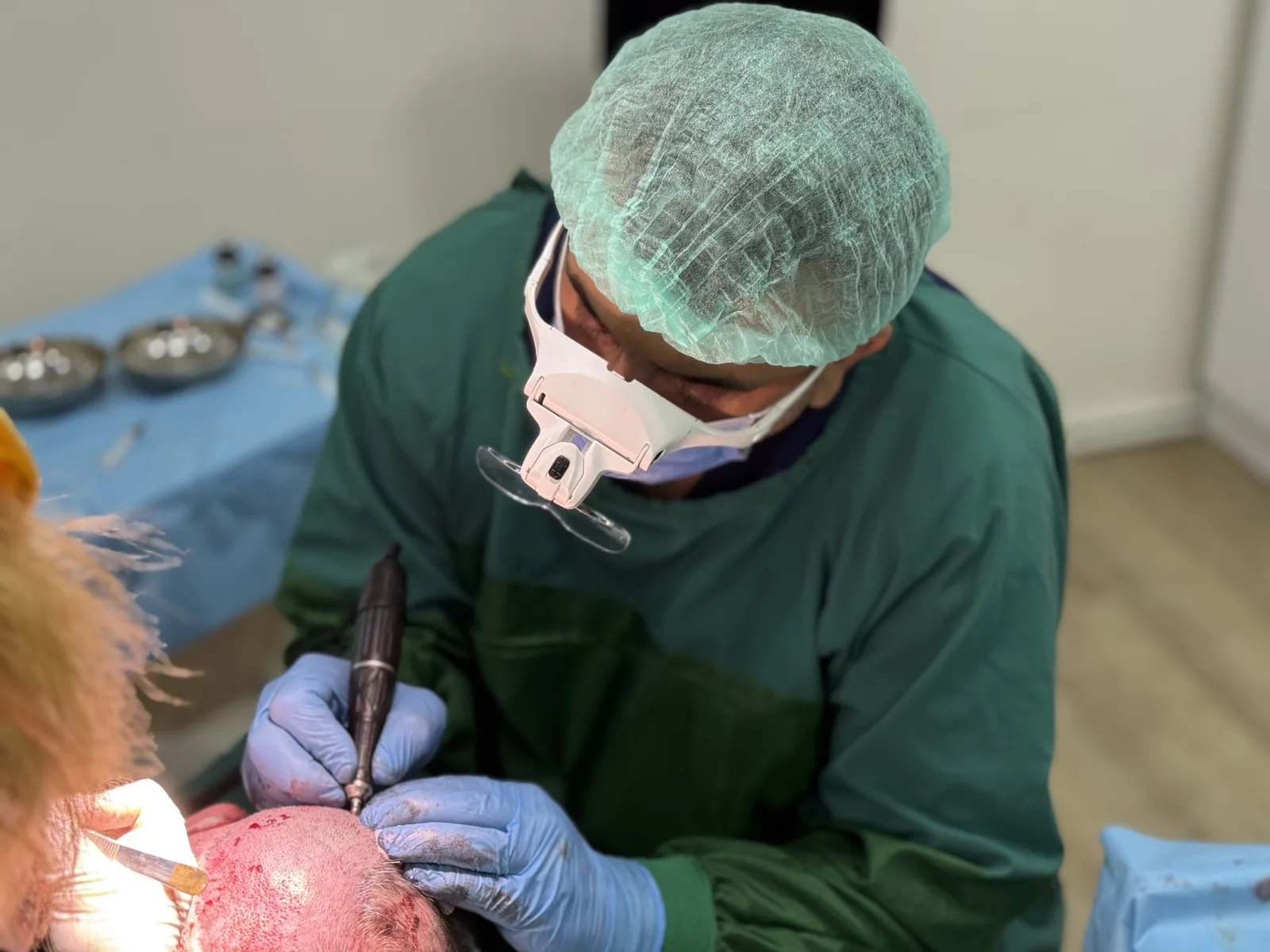 Dr. Arslan Musbeh using a precision punch instrument on the donor area during a hair transplant session at Hairmedico