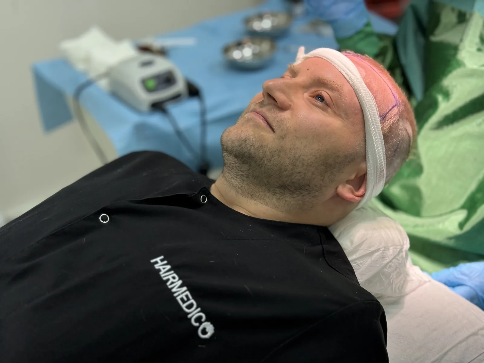 Patient prepared for extraction at Hairmedico Istanbul, donor area marked ahead of surgery