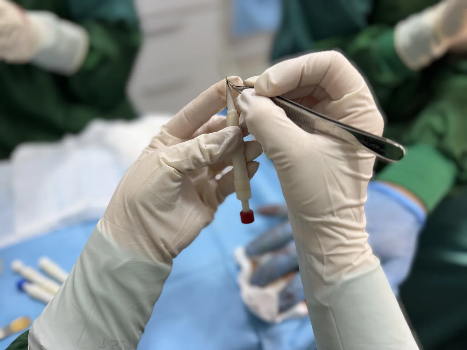 Surgeon's hands holding a sapphire blade instrument during channel creation in a hair transplant procedure